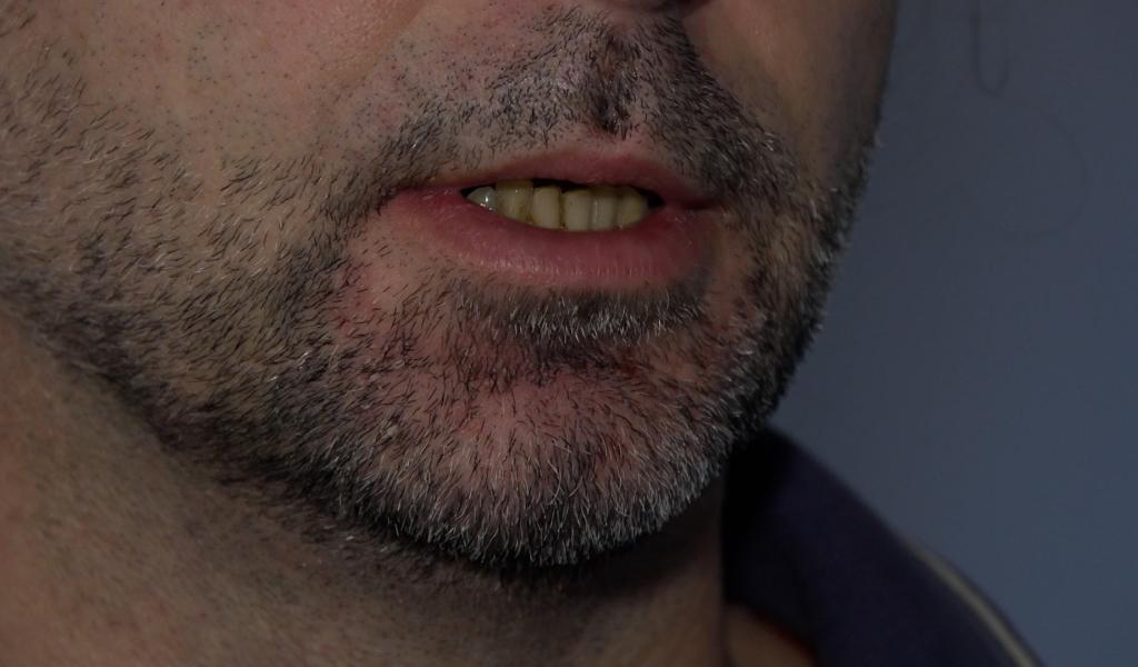 Les exclus du chômage : témoignage anonyme au CPAS de Namur