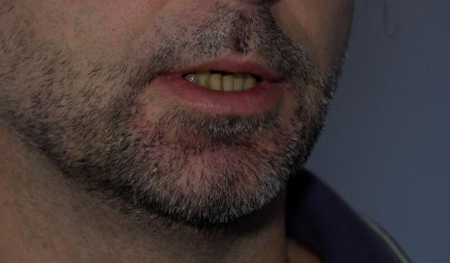 Les exclus du chômage : témoignage anonyme au CPAS de Namur